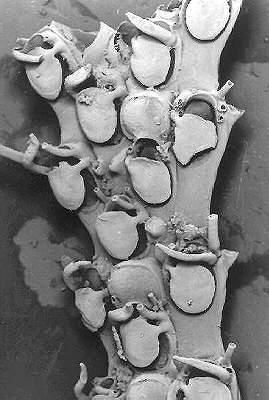 [Detail of Amastigia funiculata]
