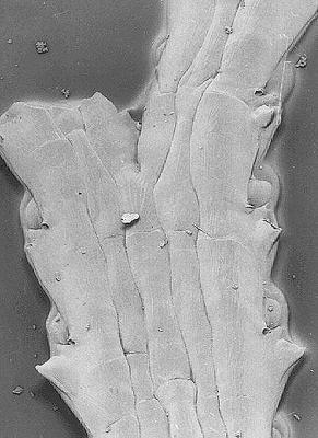 [Basal surface of Amastigia funiculata]